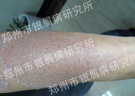 ��ȥ��ţƤ������Ȼ������